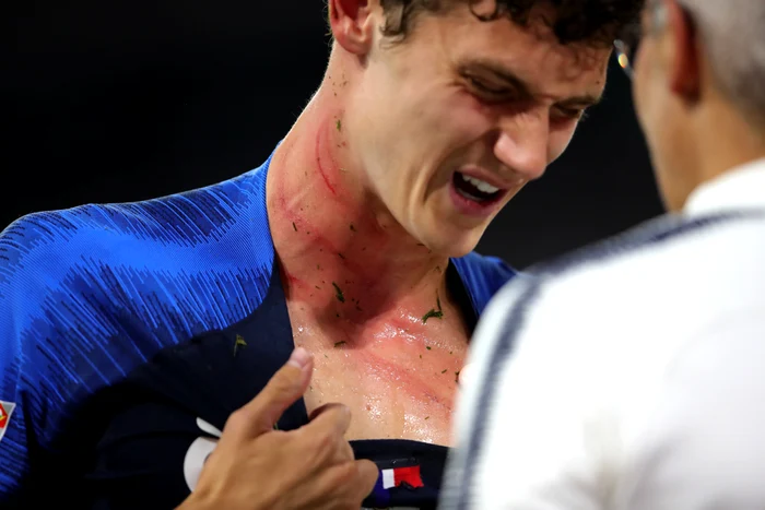 
    Francezul Pavard, şifonat serios în meciul cu Germania  