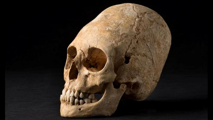 Craniul alungit era un simbol al frumuseţii şi al nobleţii pentru unele populaţii FOTO mentalfloss.com