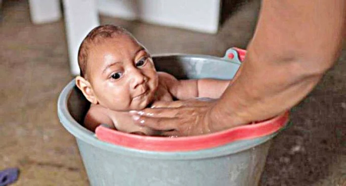 Anul trecut, în Brazilia, s-au născut 907 copii cu microcefalie