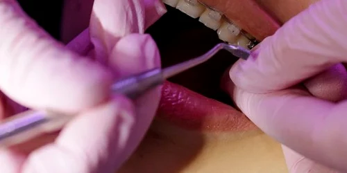 lucrare dentara 1 FOTO arhiva Adevarul (1) jpg