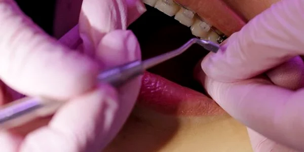 lucrare dentara 1 FOTO arhiva Adevarul (1) jpg