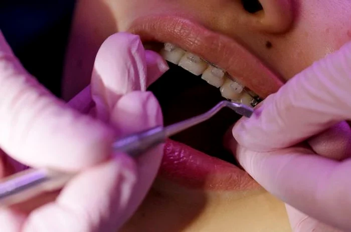 Lucrările dentare pot afecta coloana vertebrală FOTO arhivă Adevărul