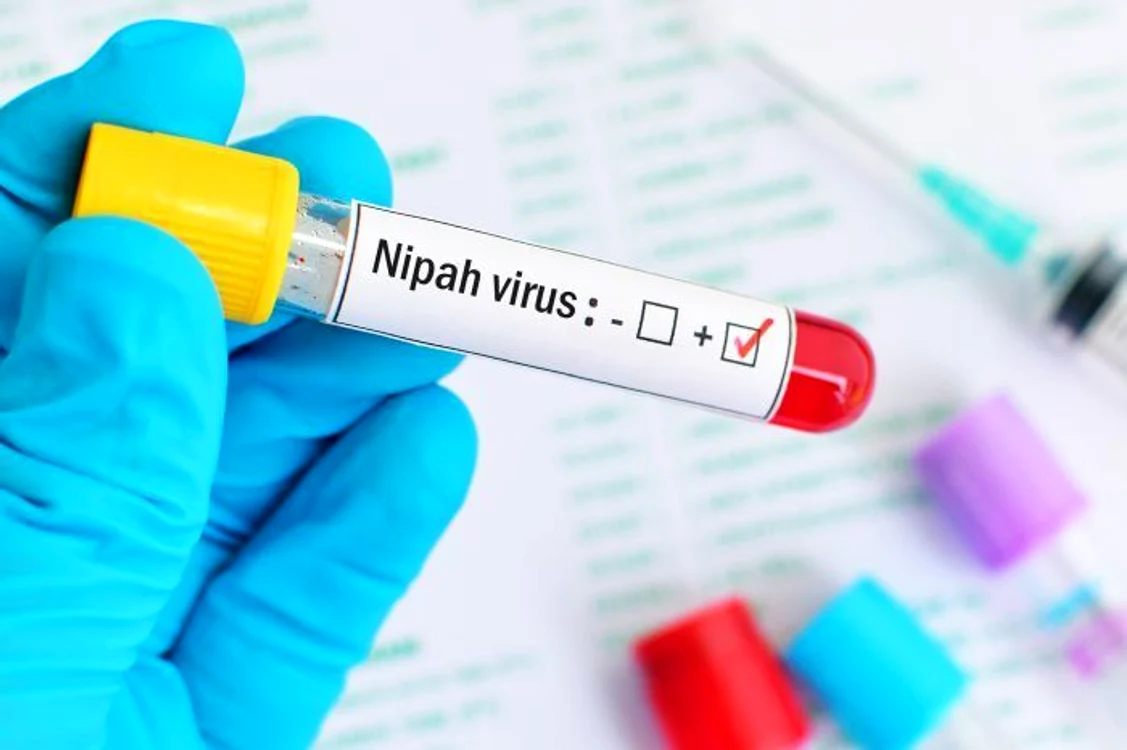 Virusul Nipah (NiV) a revenit recent în atenția medicilor. FOTO: Arhivă