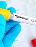 1 virus nipah jpg jpeg