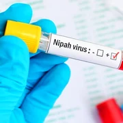 1 virus nipah jpg jpeg