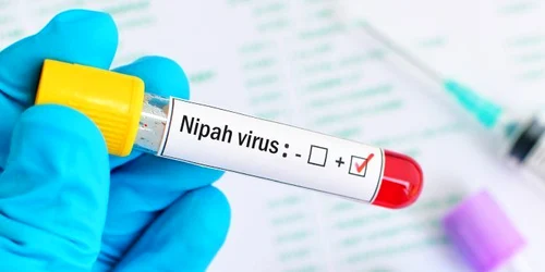1 virus nipah jpg jpeg