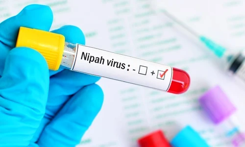 1 virus nipah jpg jpeg