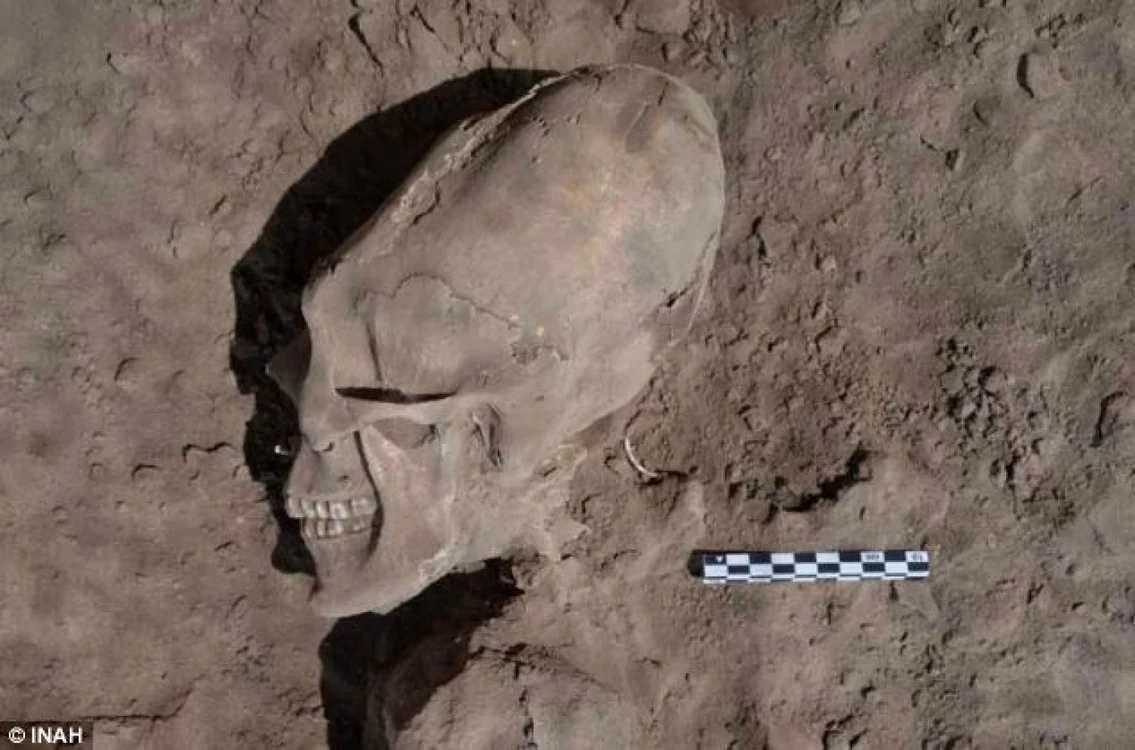 Deformarea craniilor era aplicată copiilor imediat după naştere