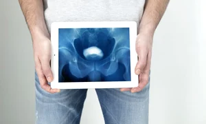 urografie jpg