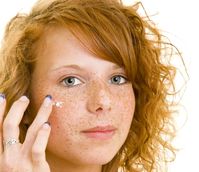 Soluţiile pe bază de plante sunt de un real folos când vine vorba de pistrui