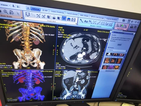 Centru de diagnosticare a cancerului, la Galați FOTO: CJ Galați
