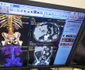 Centru de diagnosticare a cancerului, la Galați FOTO: CJ Galați