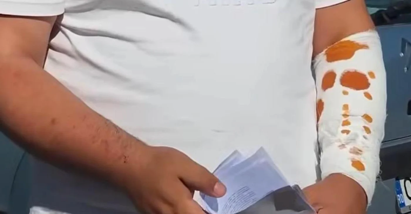 Bărbatul s-a ales cu răni la mână FOTO: captură video