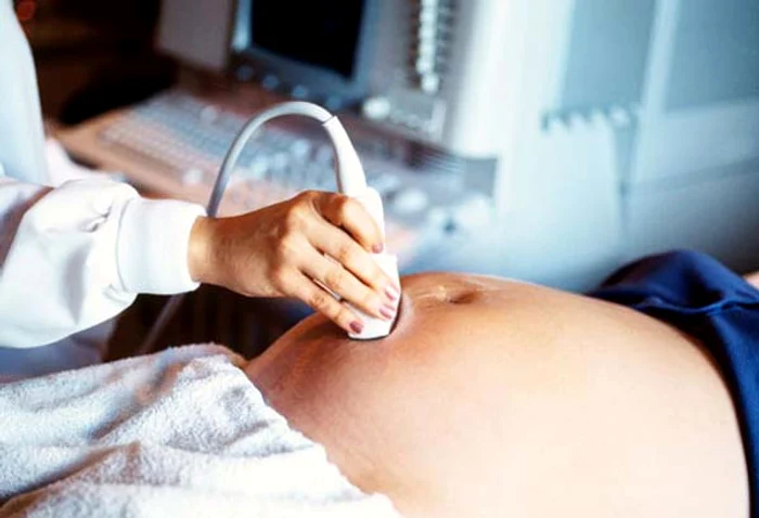 Fetiţa a adus pe lume un copil, duminică, în Grecia