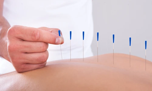 1 shutterstock 148466006 jpg jpeg