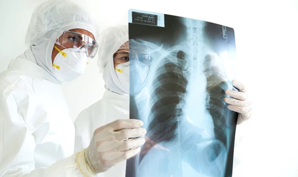 Semnal de alarmă: A crescut brusc numărul tinerilor cu cancer