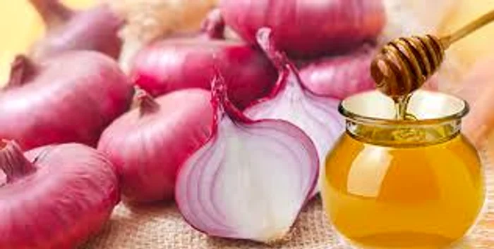 Un remediu cu ceapă roșie benefic pentru varice și pentru circulație periferică Sursa foto: Arhiva Click