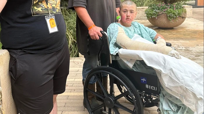 Tânărul a suferit arsuri grave / foto: GoFundMe