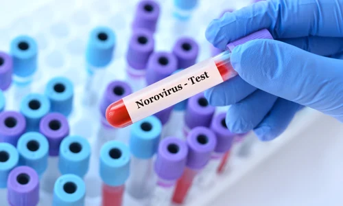 shutterstock 2400760247 jpg