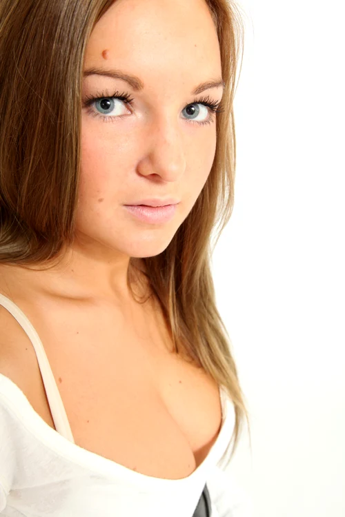 Feriți-vă alunițele de razele soarelui!foto: Shutterstock