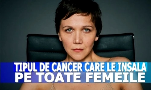 Cele mai frecvente tipuri de cancer la femei  5 din ele sunt fatale jpeg