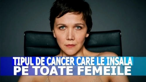 Cele mai frecvente tipuri de cancer la femei 5 din ele sunt fatale jpeg