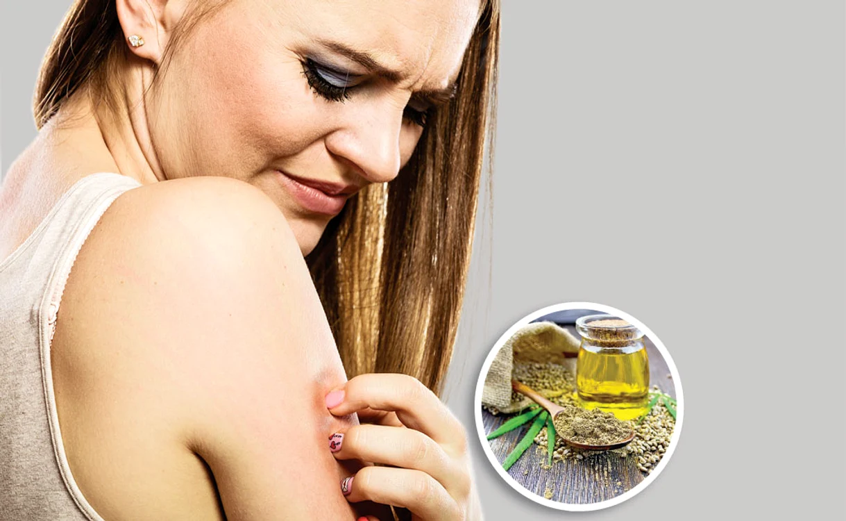 
    Chiar şi psoriazisul poate fi ameliorat prin acţiunea  de hidratare a acestui ulei-medicament  