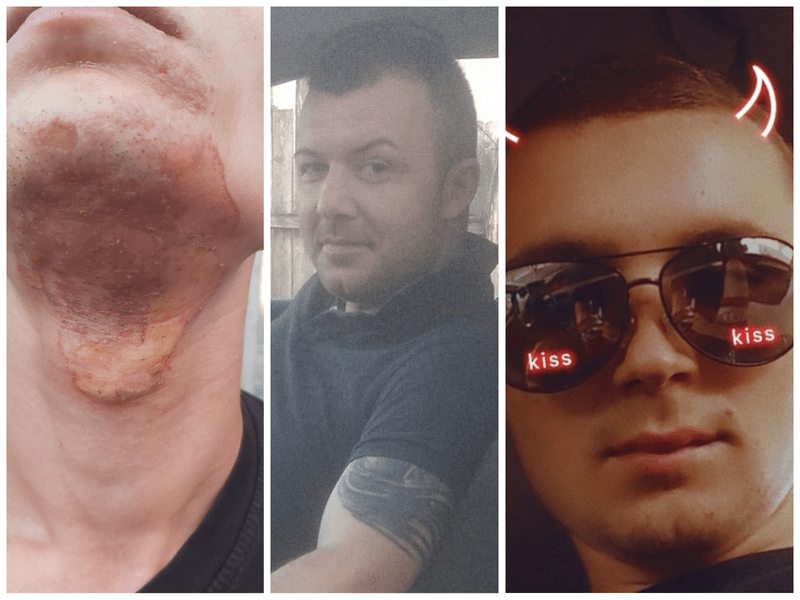 Tânăr cu retard, brutalizat și umilit timp de doi ani de colegii de muncă. Cazul este în ancheta procurorilor