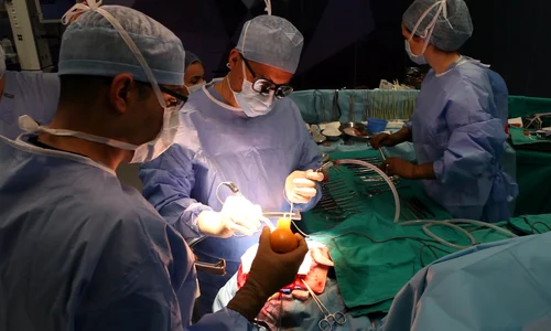 1 copii spasticitate jpg jpeg