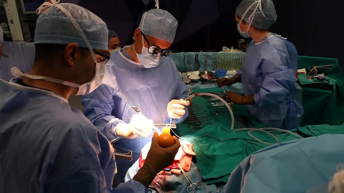 1 copii spasticitate jpg jpeg