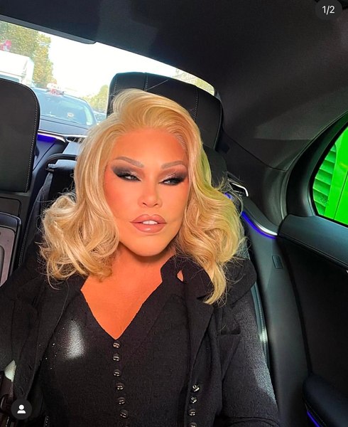 A murit Jocelyn Wildenstein, supranumită „Catwoman”. Era cunoscută pentru operaţiile sale estetice extreme