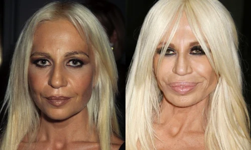 3 donatella varsace operati estetice jpg jpeg