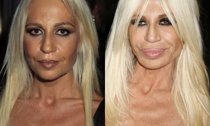 3 donatella varsace operati estetice jpg jpeg