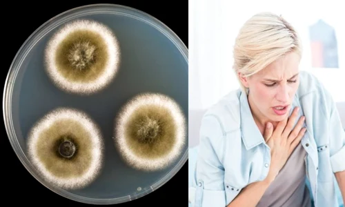 1 15 simptome care iti spun ca esti intoxicata cu mucegai din0 jpg jpeg