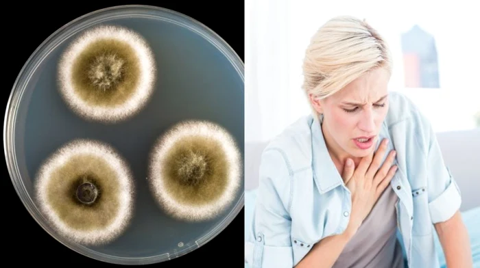 1 15 simptome care iti spun ca esti intoxicata cu mucegai din0 jpg jpeg