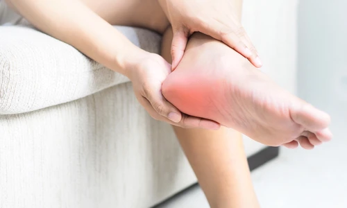 1 durerea de calcaie jpg jpeg