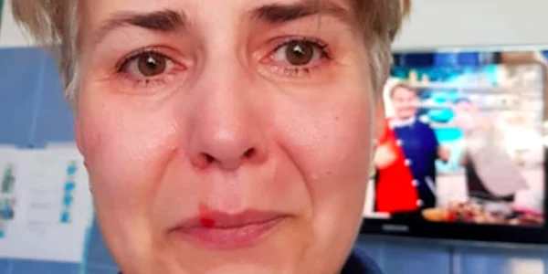 Asistenta bătută Rodica Luminiţa de la Spitalul Judeţean de Urgenţă Giurgiu Sursa Facebook RL