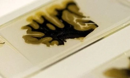 Bucăţi din creierul lui Albert Einstein, expuse la Londra jpeg