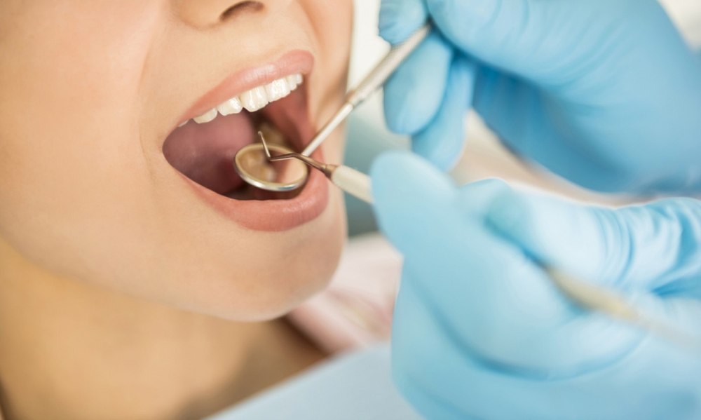 Gutierele invizibile. Ce avantaje au față de aparatele dentare fixe