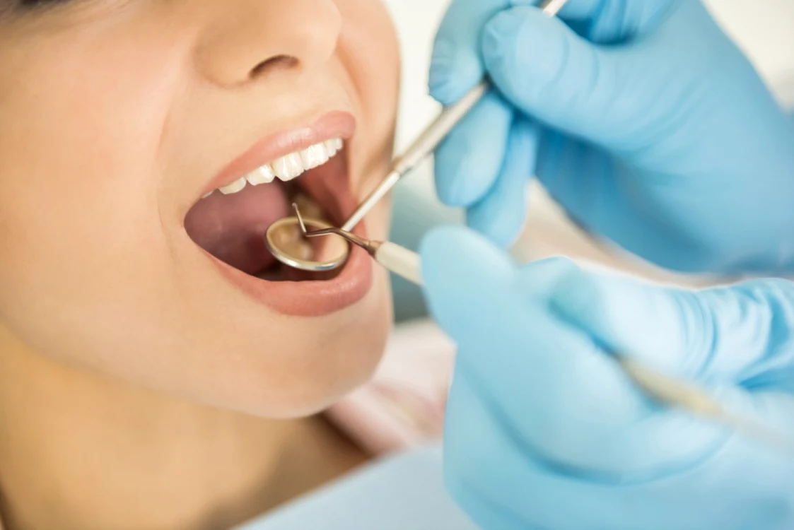 Stomatologii îşi pot da seama dacă un pacient a făcut recent felaţie, doar după o simplă examinare FOTO Shutterstock