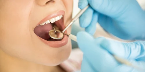 dentist foto shutterstock