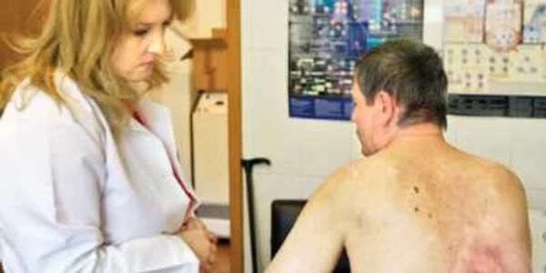 Leziunile cutanate apar  mai întâi pe faţă, dar în timp se pot extinde pe tot corpul