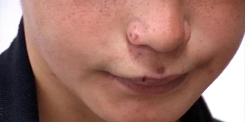 "Mi-a dat cu pumnii în faţă"