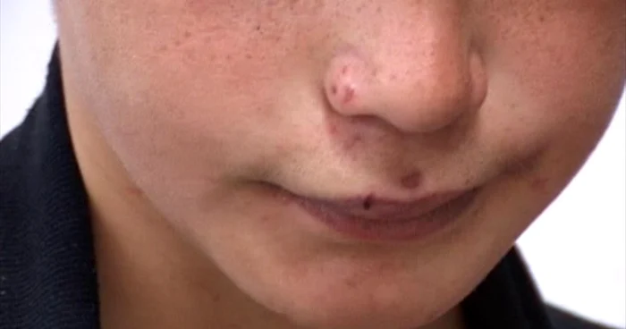 "Mi-a dat cu pumnii în faţă"