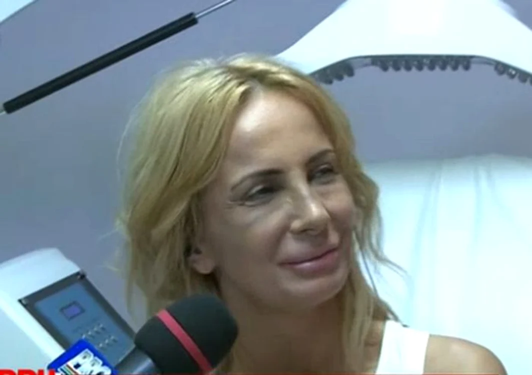 Daniela Gyorfi este încântat de felul în care arată nasul ei după operaţie. (captură Pro TV)