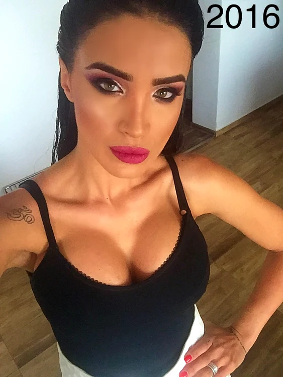 Adelina Pestrițu și-a expus silicoanele cu mândrie