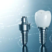 implant dentar foto pixabay tamim jpg