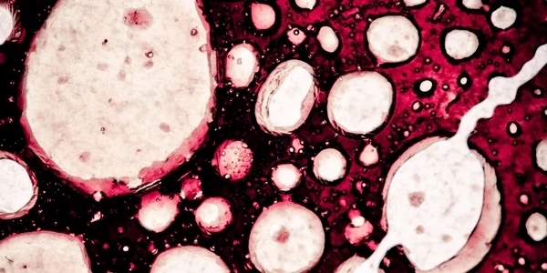 celule cancer shutterstock 78052687 0 jpeg