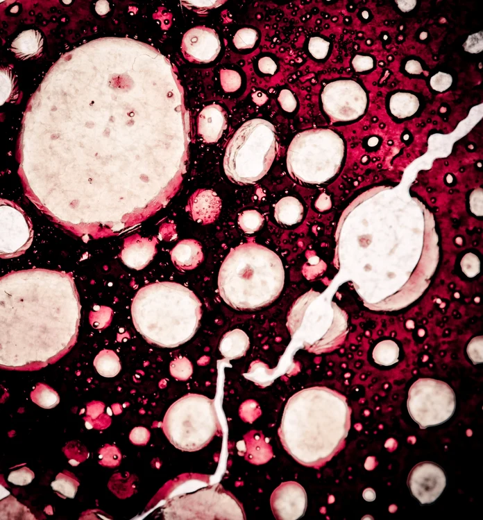 celule cancer shutterstock 78052687 0 jpeg