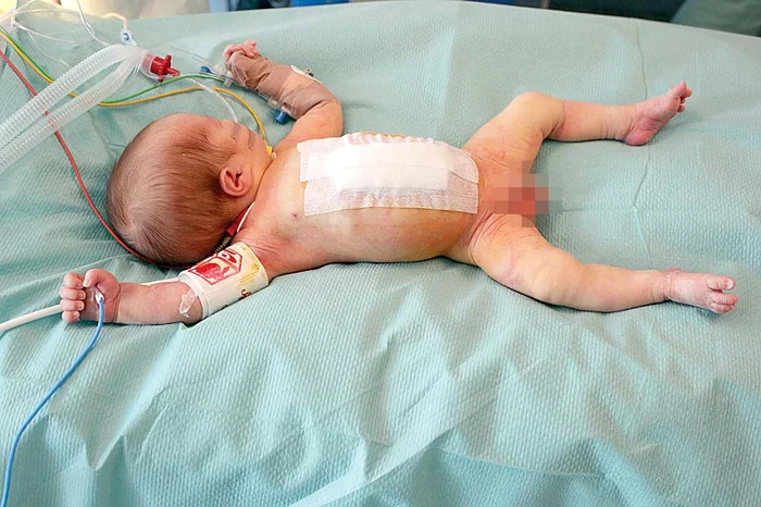 Aşa arată Andrei după operaţie